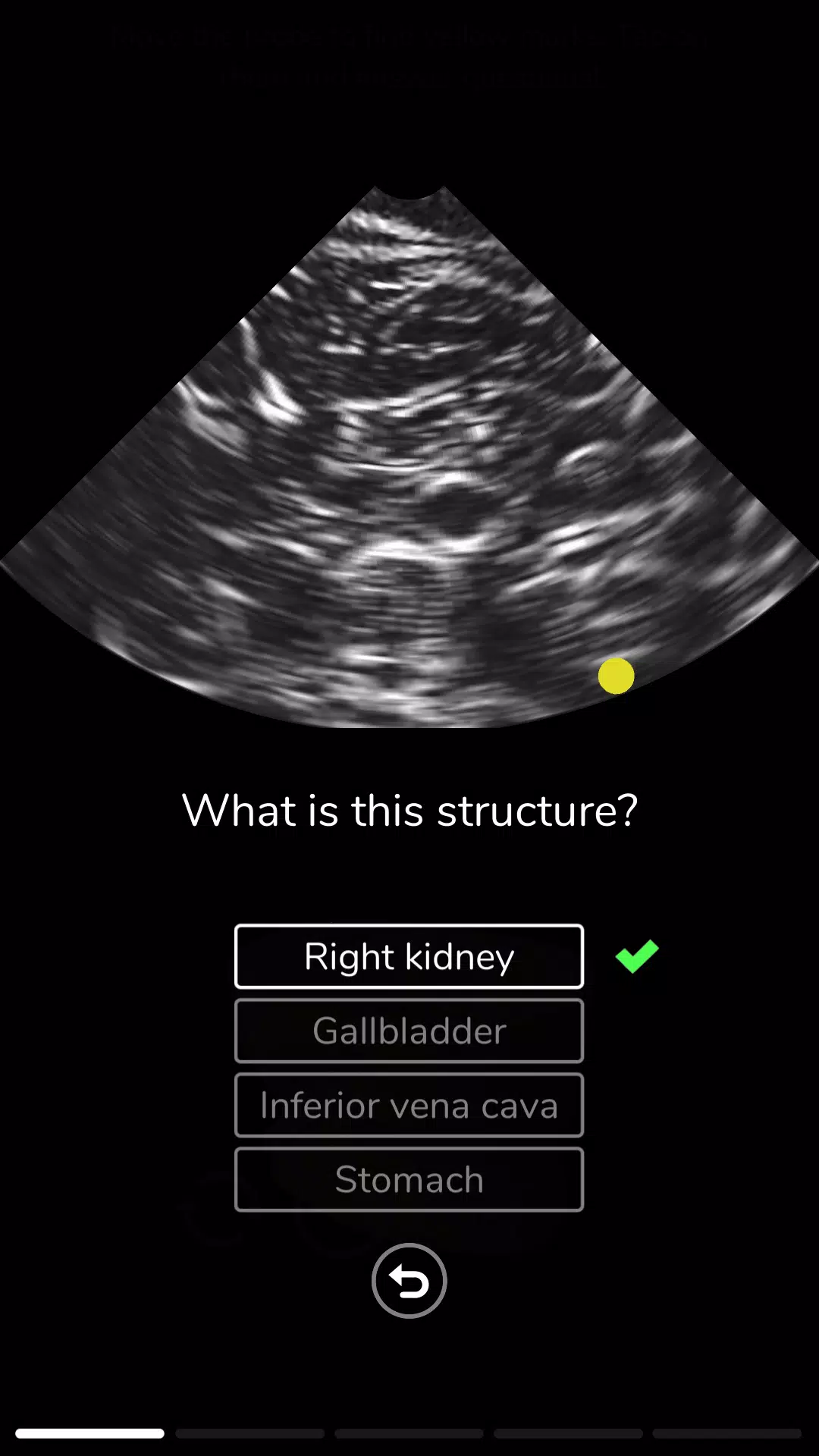 Deepscope Ultrasound Simulator স্ক্রিনশট 3